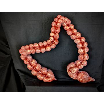 Body Part: Large Intestine