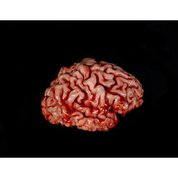 CX Body Part: Large Brain