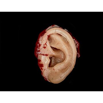 Body Part: Ear