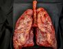 Body Part: Lungs