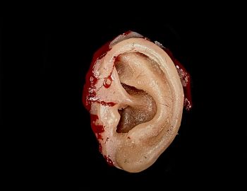 Body Part: Ear
